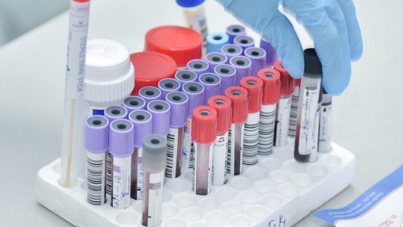 Giun dẹp và các triệu chứng khi nhiễm, cách chẩn đoán4