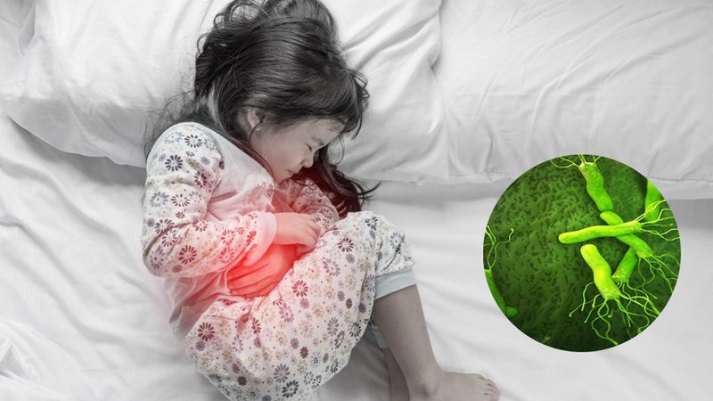 Triệu chứng nhiễm vi khuẩn hp ở trẻ em 1