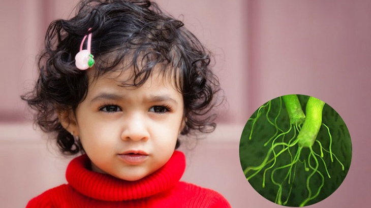 Triệu chứng nhiễm vi khuẩn hp ở trẻ em 3