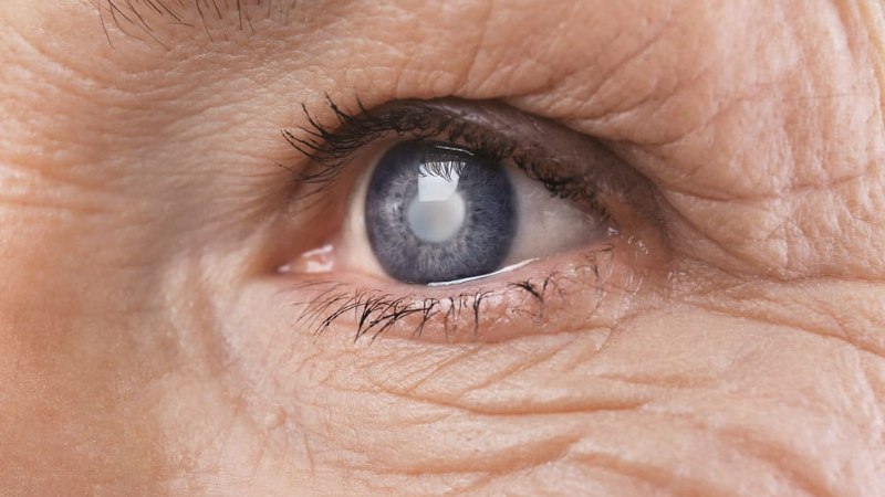 Triệu chứng zona thần kinh ở mũi và cách điều trị 3