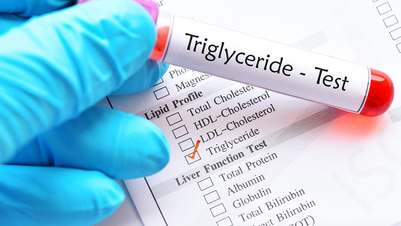 Triglyceride thấp có nguy hiểm không? Cách duy trì chỉ số triglyceride ở mức bình thường 1
