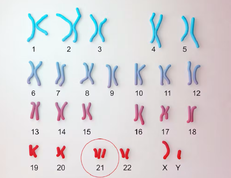 Trisomy 21 là gì? Kết quả chỉ số Trisomy 21 bao nhiêu là bình thường?2