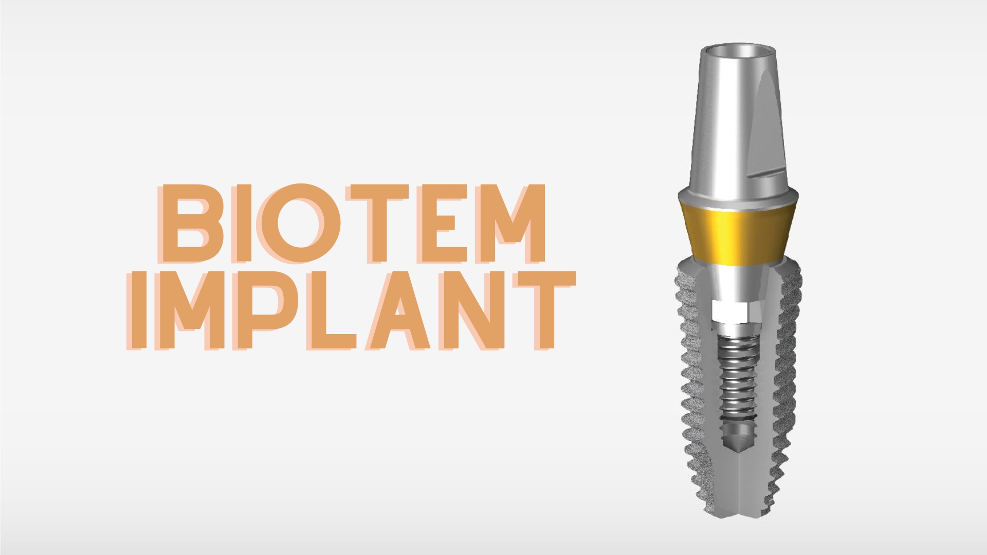 Trụ răng Biotem Implant Hàn Quốc và những điều cần biết