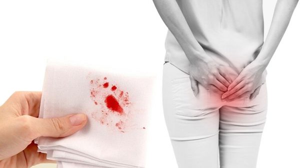 Tư thế đi vệ sinh đúng cách tốt cho sức khỏe 2