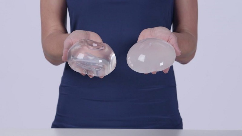 Túi ngực Nano chip là gì? Có nên nâng ngực bằng túi nano chip hay không? 2