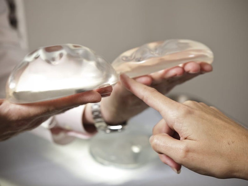 Túi ngực Nano chip là gì? Có nên nâng ngực bằng túi nano chip hay không? 4