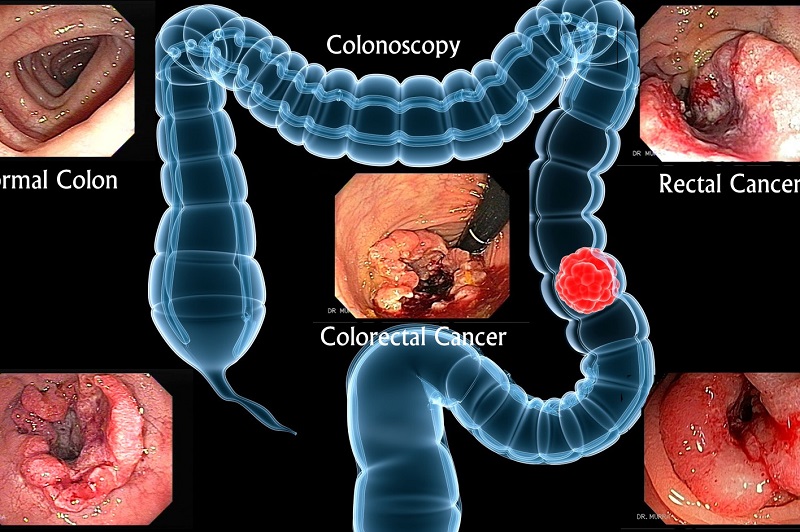 Tumor markers là gì? 6 ứng dụng của tumor markers đem lại trong lâm sàng 5
