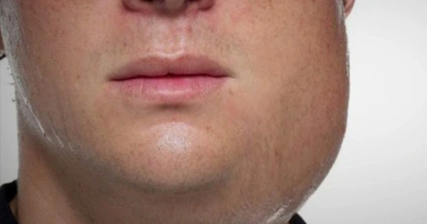 ty-le-vo-sinh-khi-bi-quai-bi-o-nam-gioi-la-bao-nhieu 1.jpg