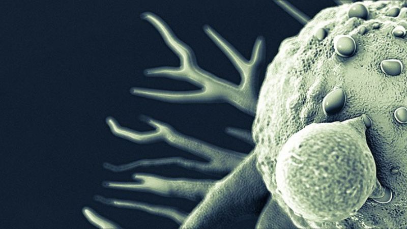 U lymphô ác tính không hodgkin là gì và dấu hiệu nhận biết 2