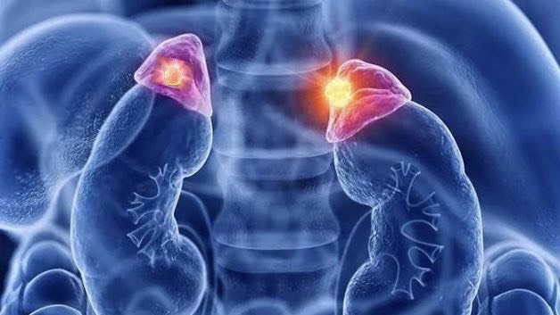 u-tuyen-thuong-than-nguy-co-tiem-an-dang-sau-can-benh-tang-huyet-ap 1