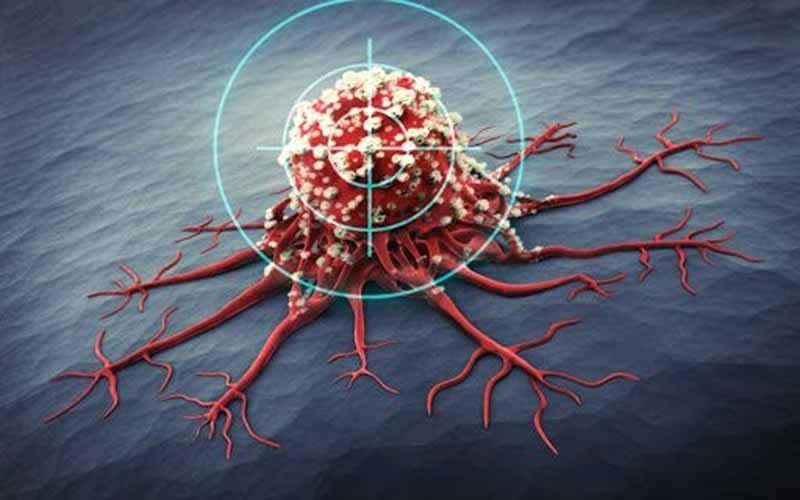 U xơ thần kinh mụn thịt là gì? Những thông tin cần biết 1