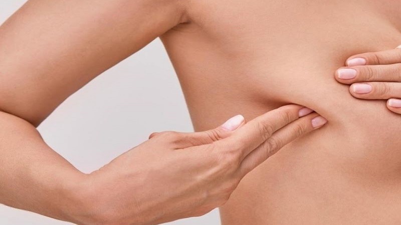 U xơ tuyến vú có nên mổ hay chỉ cần theo dõi, thăm khám định kỳ? 4