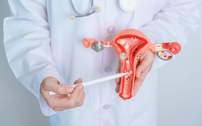 Ung thư biểu mô cổ tử cung: Nguyên nhân, triệu chứng và cách điều trị 2