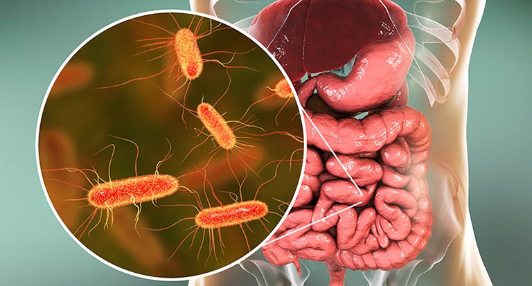 Ung thư dạ dày có di truyền không? Giảm nguy cơ ung thư dạ dày 1