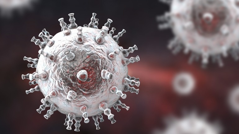 ung-thu-kaposi-la-gi-trieu-chung-ung-thu-kaposi Cropped.jpg