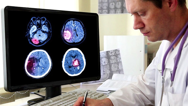 ung-thu-nao-co-chua-duoc-khong-co-nhung-yeu-to-nao-anh-huong-den-hieu-qua-dieu-tri 3