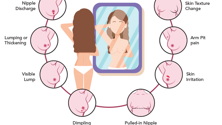 Ung thư vú giai đoạn 0 là gì? Những vấn đề cần biết về Ung thư vú giai đoạn 0 1.png