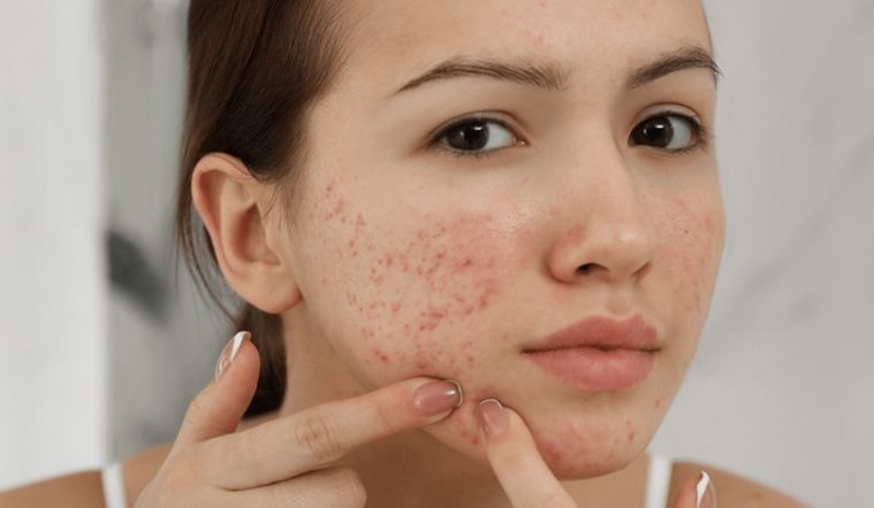 Uống hà thủ ô có đẹp da không? Những thông tin cần biết 3