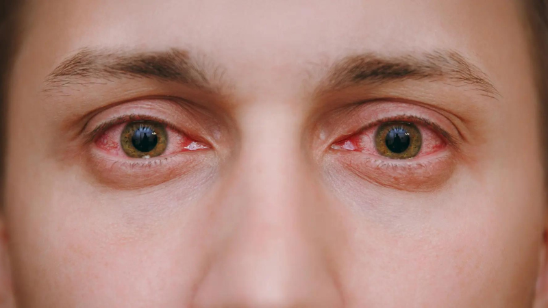 Hỏi đáp: Uống rượu nhiều có ảnh hưởng đến mắt không? 1