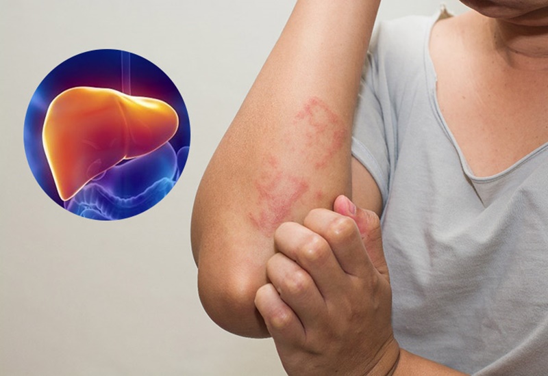 Uống trà sữa có nổi mụn không? 3