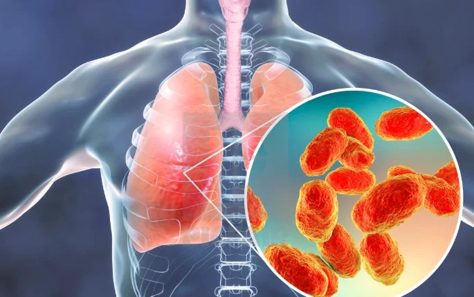 Vắc xin QuimiHib (Cuba) 5