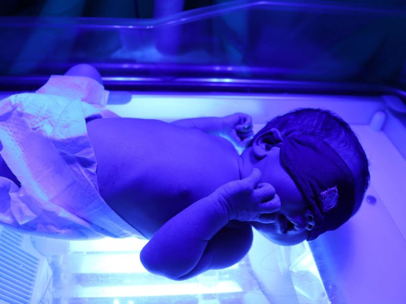 vang-da-o-tre-so-sinh-co-nguy-hiem-khong-nhung-dieu-bo-me-can-biet 3