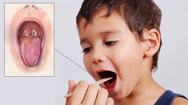 vi-khuan-bach-hau-song-duoc-o-nhiet-do-nao 3.jpg