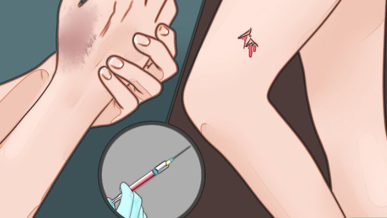 vi-sao-can-phai-tiem-phong-uon-van-sau-khi-chan-thuong 1.jpg