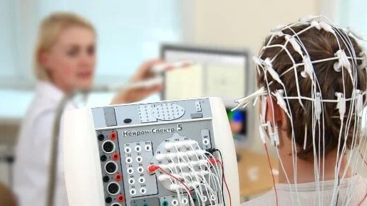 Vì sao cần thực hiện ghi điện não đồ lúc ngủ? 1