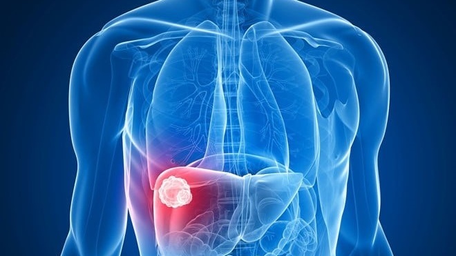 Viêm gan B có ảnh hưởng đến tinh trùng không? 2