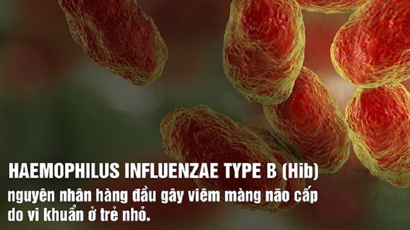 viem-mang-nao-mu 2.jpg