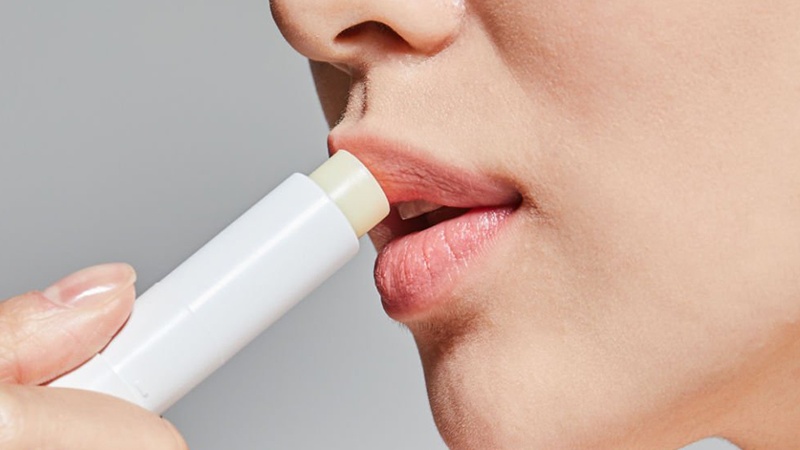 Viêm môi bong vảy sau phun môi 3