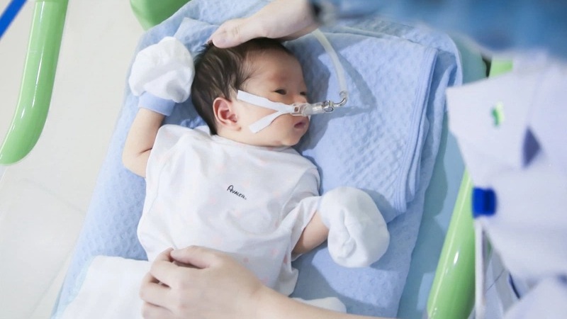 Viêm phổi ở trẻ sinh non: Dấu hiệu nhận biết và cách phòng ngừa 1