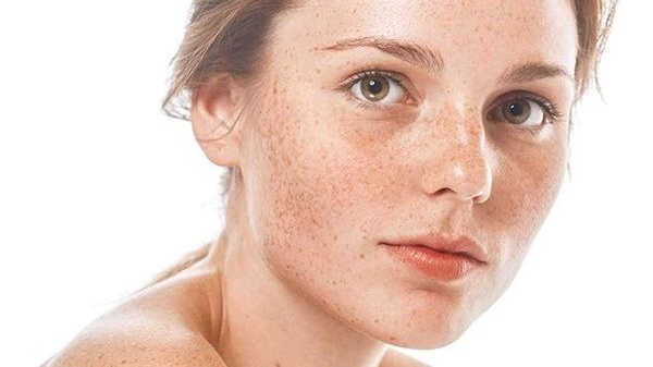 Viên uống Bảo Xuân có trị nám không? Những điều cần biết 1