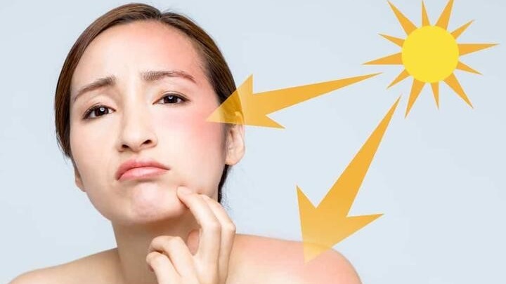 Viên uống Bảo Xuân có trị nám không? Những điều cần biết 2