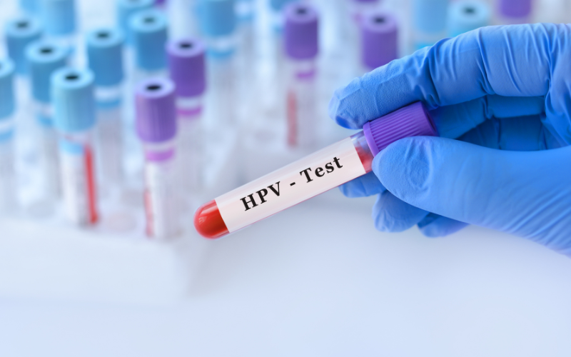 Virus HPV lây qua đường nào? Làm sao để tránh lây nhiễm? 3