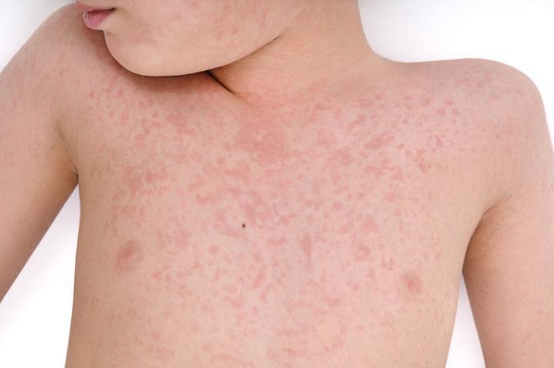Virus là gì? Chúng có thể gây ra những bệnh gì? 3