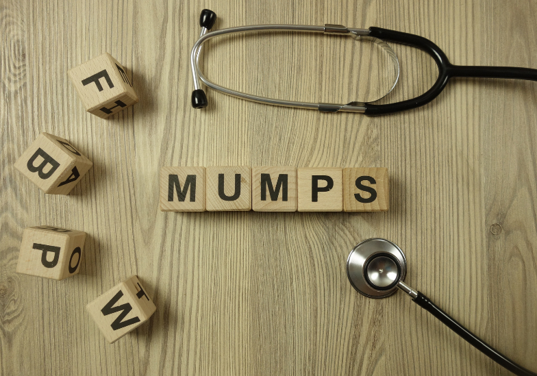 Virus quai bị: Những điều cần biết để bảo vệ sức khỏe bản thân và gia đình 1