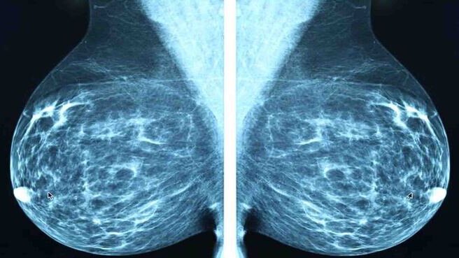 voi-hoa-tuyen-vu-nguyen-nhan-la-do-dau 1.jpg