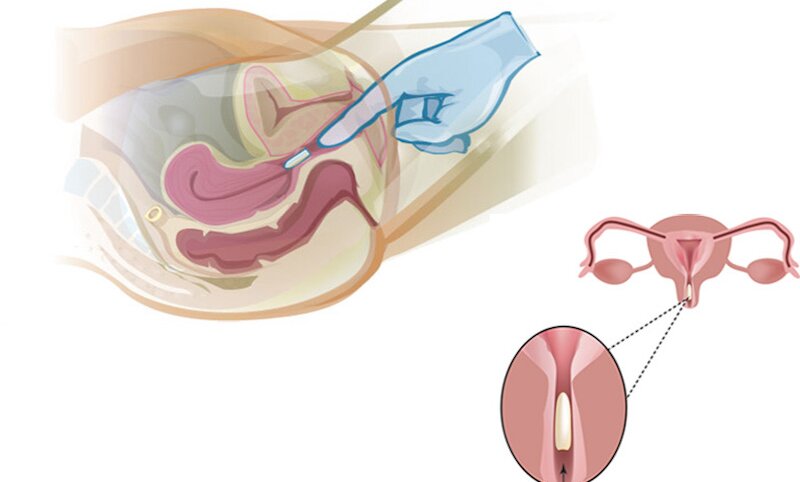 vua-quan-he-xong-co-dat-thuoc-duoc-khong 1.jpg