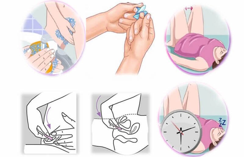 vua-quan-he-xong-co-dat-thuoc-duoc-khong 3.jpg