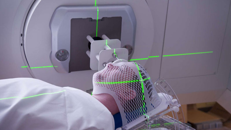 Xạ trị VMAT là gì? Đối tượng chỉ định là những ai? 2