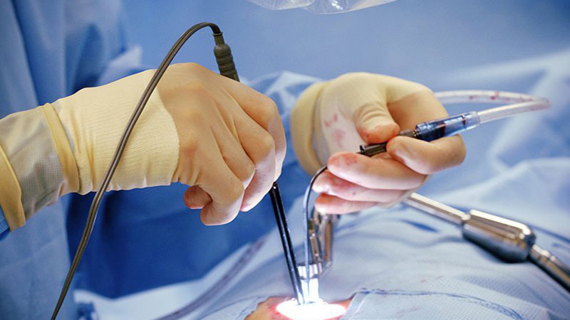 Xây dựng chế độ ăn của người mổ lá lách đảm bảo phục hồi nhanh 1