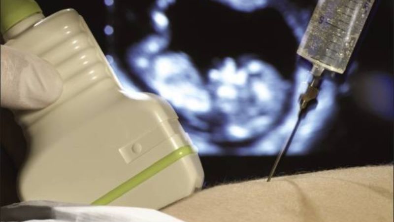 Xét nghiệm ADN thai nhi có chính xác không? 1