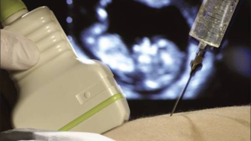 Xét nghiệm ADN thai nhi hết bao nhiêu tiền? 2