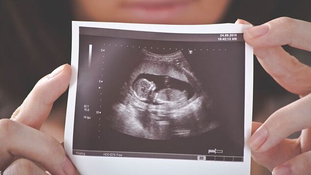 Xét nghiệm bầu 12 tuần có cần nhịn ăn không? 2