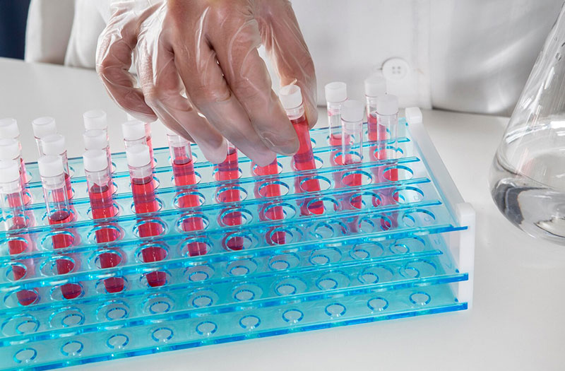 Xét nghiệm Cytochrome P450 là gì? Những thông tin cần biết 2