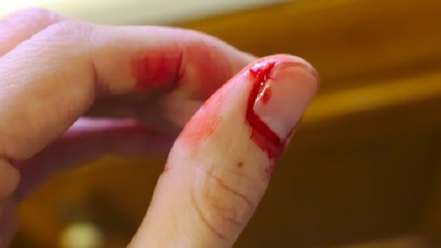 Xét nghiệm gen Hemophilia là gì? 3