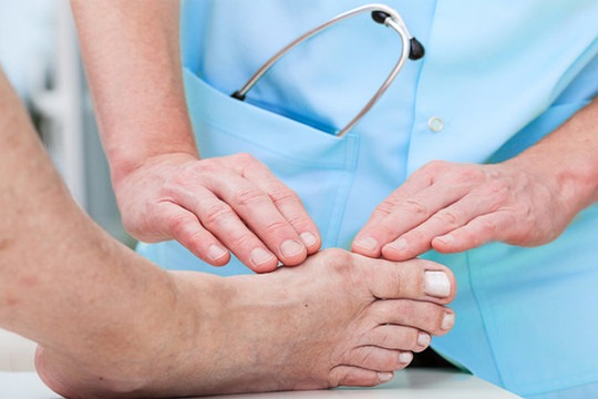 Xét nghiệm gout là gì? Khi nào cần thực hiện xét nghiệm gout? 1