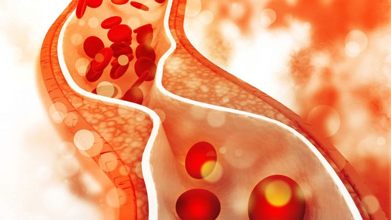 xet-nghiem-hdl-cholesterol-la-gi-khi-nao-can-thuc-hien-loai-xet-nghiem-nay 1